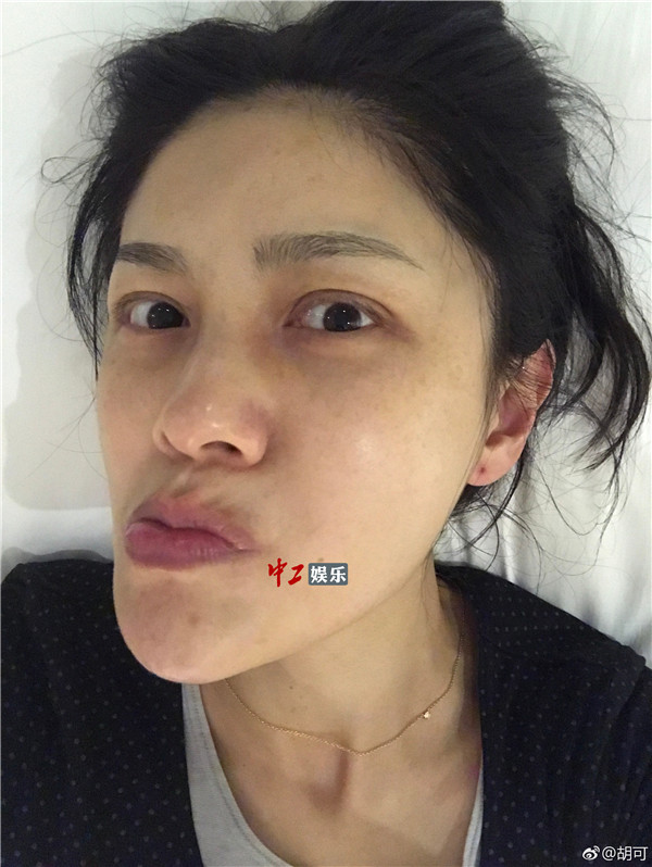 胡可曬素顏斗圖放飛自我 網友：沙溢快來出大事啦！