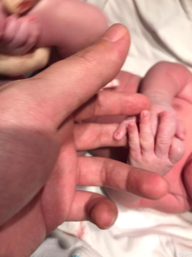 “賢惠”的男星：張杰為謝娜發(fā)聲 黃曉明減工陪baby