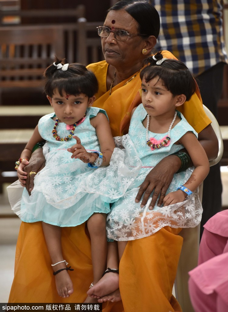 活下去就有希望 印度連體姐妹分離手術成功茁壯成長